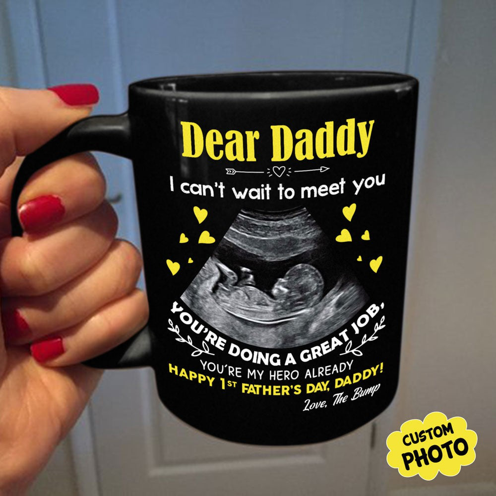 For Expecting Dad Ultrasound Sonogram Father's Day Personalized Mug